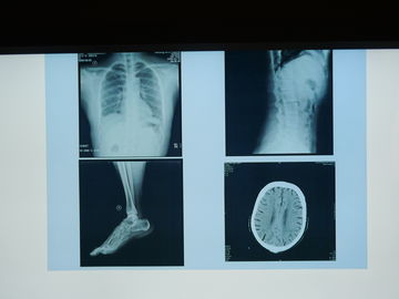 Film d'imagerie médicale de Konida X Ray imperméable pour l'imprimante d'Agfa