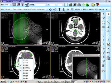 8 représentation diagnostique médicale du laser X Ray de papier de x 10inch pour KND-DRYTEC 4000