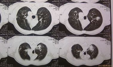 Film sec médical qui respecte l'environnement Agfa 2B X Ray avec la machine de CT