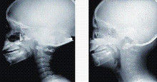 Représentation diagnostique élevée de la couverture X Ray d'encre, film médical de rayon de x de laser de 35 x de 43cm