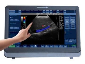 Portable médical de système d'ultrason de Doppler de la couleur 3D/4D avec le moniteur de 15 pouces LED