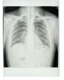 Coutume film médical de papier de rayon X de base de blanc de 25cm * de 30cm avec des matériaux d'ANIMAL FAMILIER