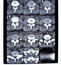 Film de X Ray de Digital de transparent, imagerie médicale AGFA/film sec de Fuji X Ray