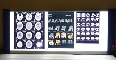 Base sèche médicale lumineuse de bleu de laser de film d'imprimante thermique de X Ray