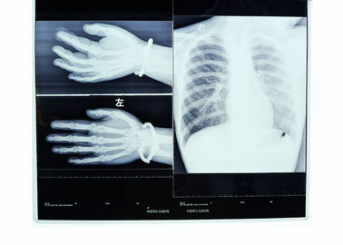 Bas brouillard film sec d'imprimante thermique de transparent de rayon X d'imagerie médicale de 14in * de 17in