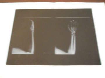 Film sec médical de représentation de bas brouillard de KND-A pour l'examen de X Ray sur le × 14in d'AGFA 5300 11in