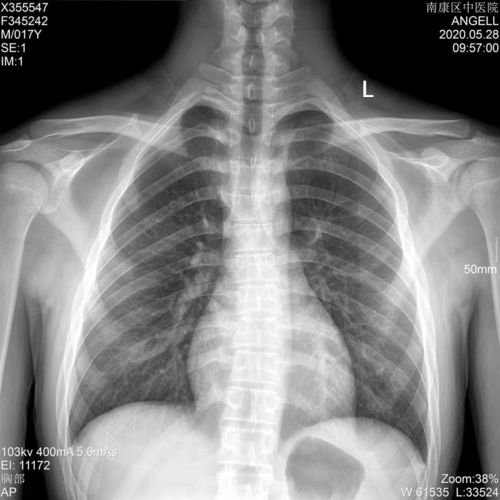 Latest company blogs about Film médical à rayons X