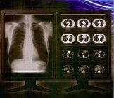 Film clair lumineux de X Ray de Digital, film médical de transparent de laser de Konida