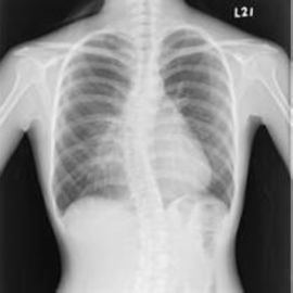 Good price KND-A/films médicaux X Ray de F en ligne