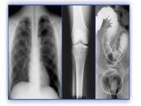 Good price Film olographe d'imagerie médicale, film de l'ANIMAL FAMILIER X Ray d'imprimantes thermiques en ligne