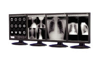 affichages Anti-réfléchis de catégorie médicale utilisés dans l'équipement d'imagerie médicale