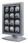 Affichages clairs de catégorie médicale d'image, affichage médical de la gamme de gris 5MP