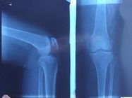Représentation diagnostique bleue de X Ray, film photographique de laser de rayon X médical de papier