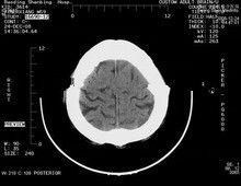 Bon prix 8 x 10 films radiographiques de papier médicaux Éraflure-résistants pour des imprimantes à laser De Konida en ligne