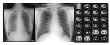 Bon prix imprimante thermique Film de 14in x 17 pouces en ligne
