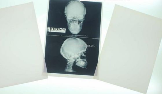 Bon prix Konida 10in x 12in X Ray Medical Imaging en ligne