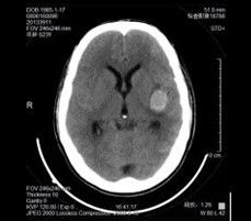 Bon prix Courant ascendant sec médical de film de X Ray de Konida pour AGFA 5300/Fuji 3000 en ligne