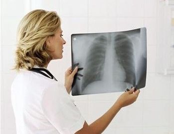 Good price 20cm x 25cm X Ray Diagnostic Imaging en ligne