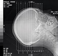 Bon prix La représentation diagnostique du laser X Ray d'halogénure d'argent, A3/A4 imperméabilisent le film de transparent en ligne