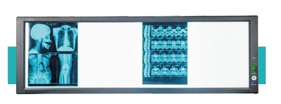 Bon prix Boîte de visionneuse médicale à LED super lumineuse en ligne