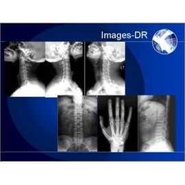 Bon prix Machine de radiographie de Digital de RAYON X de Mammogrpahy avec le bras flexible d'UC en ligne