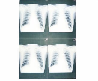 Good price Film médical bas blanc de papier de X Ray étanche à l'humidité pour l'imprimante à laser de Sony/EPSON en ligne