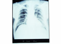 Film sec d'imagerie médicale de bas brouillard KND-A/KND-F pour les imprimantes thermiques