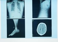 Représentation diagnostique durable de X Ray, film bleu de X Ray de laser de papier médical de 32cm x de 43cm