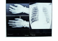 10 x 14inch sèchent les films médicaux de X Ray pour Fuji 3000/2000/1000