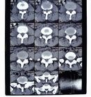 Film sec diagnostique du laser X Ray médical pour l'imprimante d'AGFA/Fuji