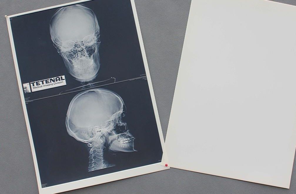 Acuité élevée imperméable de film de papier médical blanc du coffre X Ray