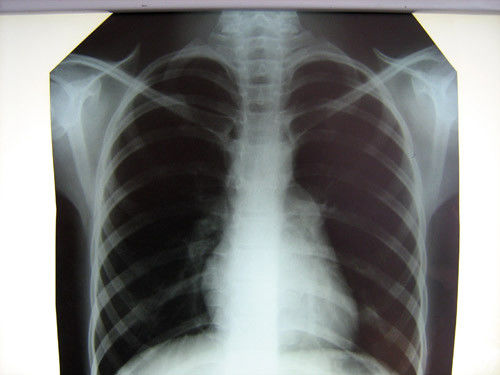 Film radiographique médical clair d'hôpital Konida avec les imprimantes thermiques
