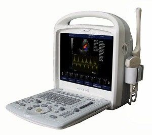 Portable Plein-numérique de système d'ultrason de Doppler de la couleur 15inch avec le logiciel 3D/4D