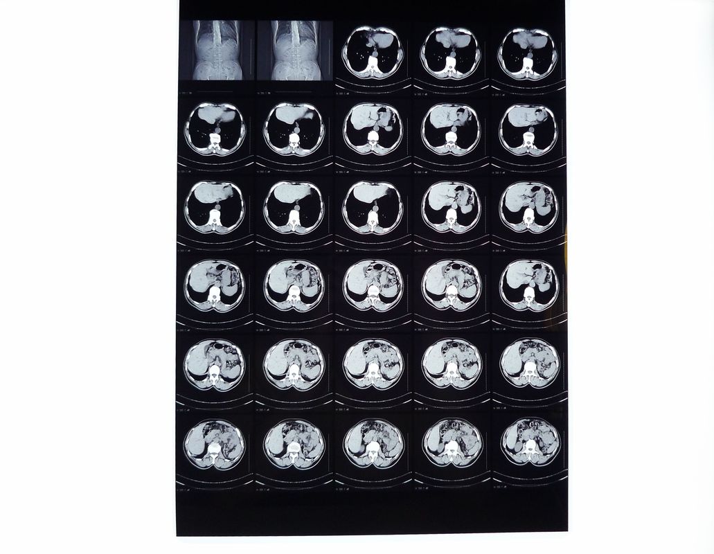 Films médicaux de rayon de X, film sec de représentation compatible avec l'imprimante thermique pour le CT/DR/IRM
