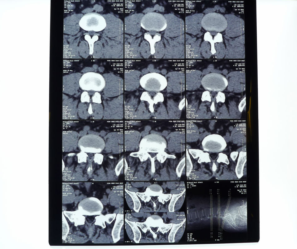 8in* 10in film sec d'imprimante thermique de rayon X médical à haute densité de 14in * de 17in