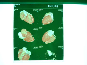 Film sec médical de X Ray de Digital, Dt2b/film sec médical représentation de Dt1b Agfa