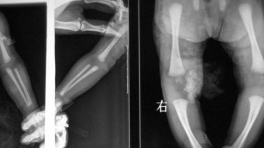 Good price imagerie médicale du laser X Ray de 20 x de 25cm, film de DT1B/DT2B Agfa X Ray en ligne
