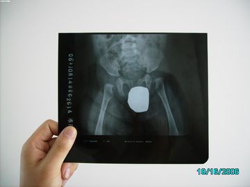 Good price Imagerie médicale Agfa mince imperméable DRYSTAR DT1B/DT2B du laser X Ray d'halogénure d'argent en ligne
