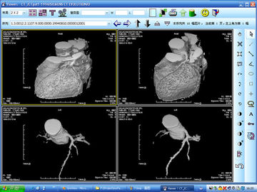 Good price Halogénure d'argent de représentation diagnostique de l'imprimante à laser X Ray pour KND-DRYTEC 4000 en ligne