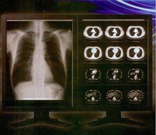 Good price Film clair lumineux de X Ray de Digital, film médical de transparent de laser de Konida en ligne