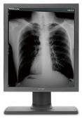 Good price 4096 affichages G51SP de catégorie médicale de gamme de gris a cinq millions de pixels en ligne