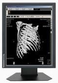 Good price 850cd/m2 le type catégorie médicale d'éclat montre 20,1 » tailles G51SP en ligne