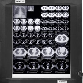 Films médicaux bas blancs portables de X Ray, film de papier de rayon X d'imagerie médicale
