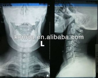 Good price Représentation diagnostique médicale d'acuité élevée, film sec d'AGFA X Ray en ligne