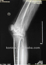 Good price Représentation diagnostique durable de X Ray, film bleu de X Ray de laser de papier médical de 32cm x de 43cm en ligne