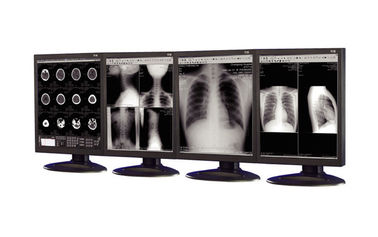 Good price affichages Anti-réfléchis de catégorie médicale utilisés dans l'équipement d'imagerie médicale en ligne