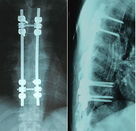 Film sec pointu de X Ray de Digital radiologique pour Fujifilm Instax 2000