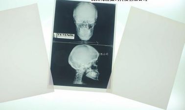 Film médical de papier bas blanc dégradable de rayon X pour l'imprimante à laser