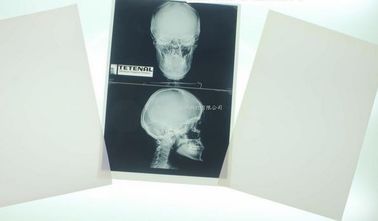 Good price représentation diagnostique médicale de 11 x 14 lasers pour l'imprimante à laser De Konida en ligne