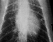 Good price Bas brouillard 11 x film radiographique 14 de papier pour les imprimantes à laser Médicales KND-K en ligne